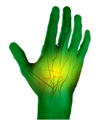 Peripheral Neuropathy Manifestation - Active