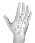 Peripheral Neuropathy Manifestation